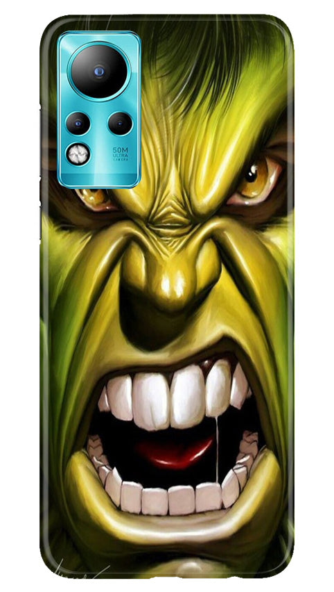 Hulk Superhero Case for Infinix Note 11(Design - 121)