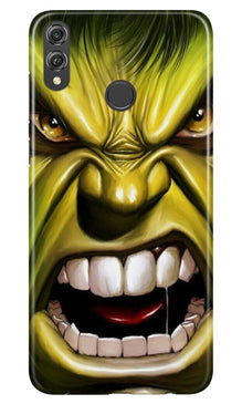 Hulk Superhero Mobile Back Case for Infinix Hot 7 Pro  (Design - 121)