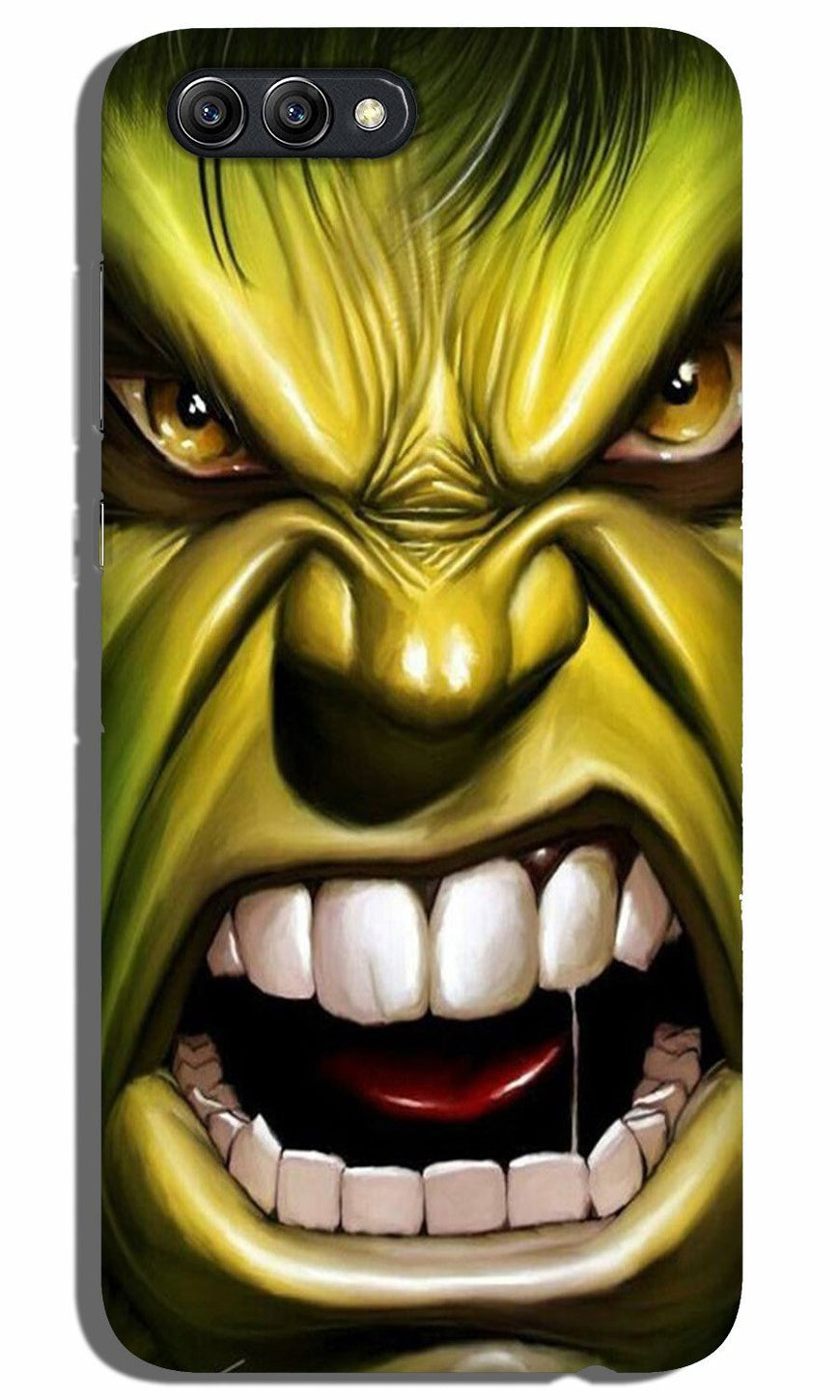 Hulk Superhero Case for Realme C1  (Design - 121)