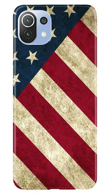 America Mobile Back Case for Mi 11 Lite 5G  (Design - 79)