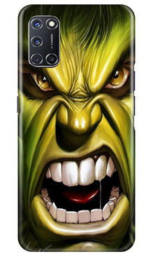 Hulk Superhero Mobile Back Case for Oppo A92  (Design - 121)