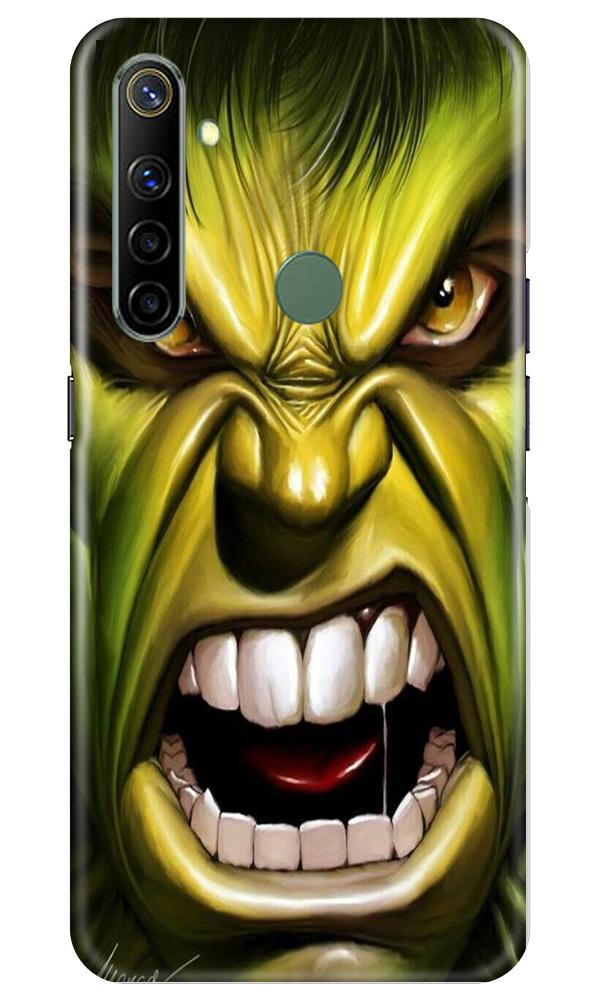 Hulk Superhero Case for Realme Narzo 10  (Design - 121)