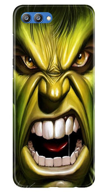 Hulk Superhero Mobile Back Case for Honor View 10  (Design - 121)